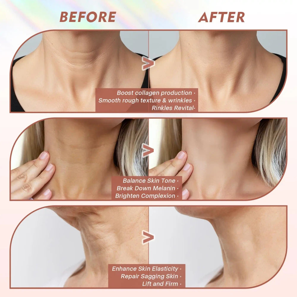Photon Anti-Wrinkle Neck LED Mask