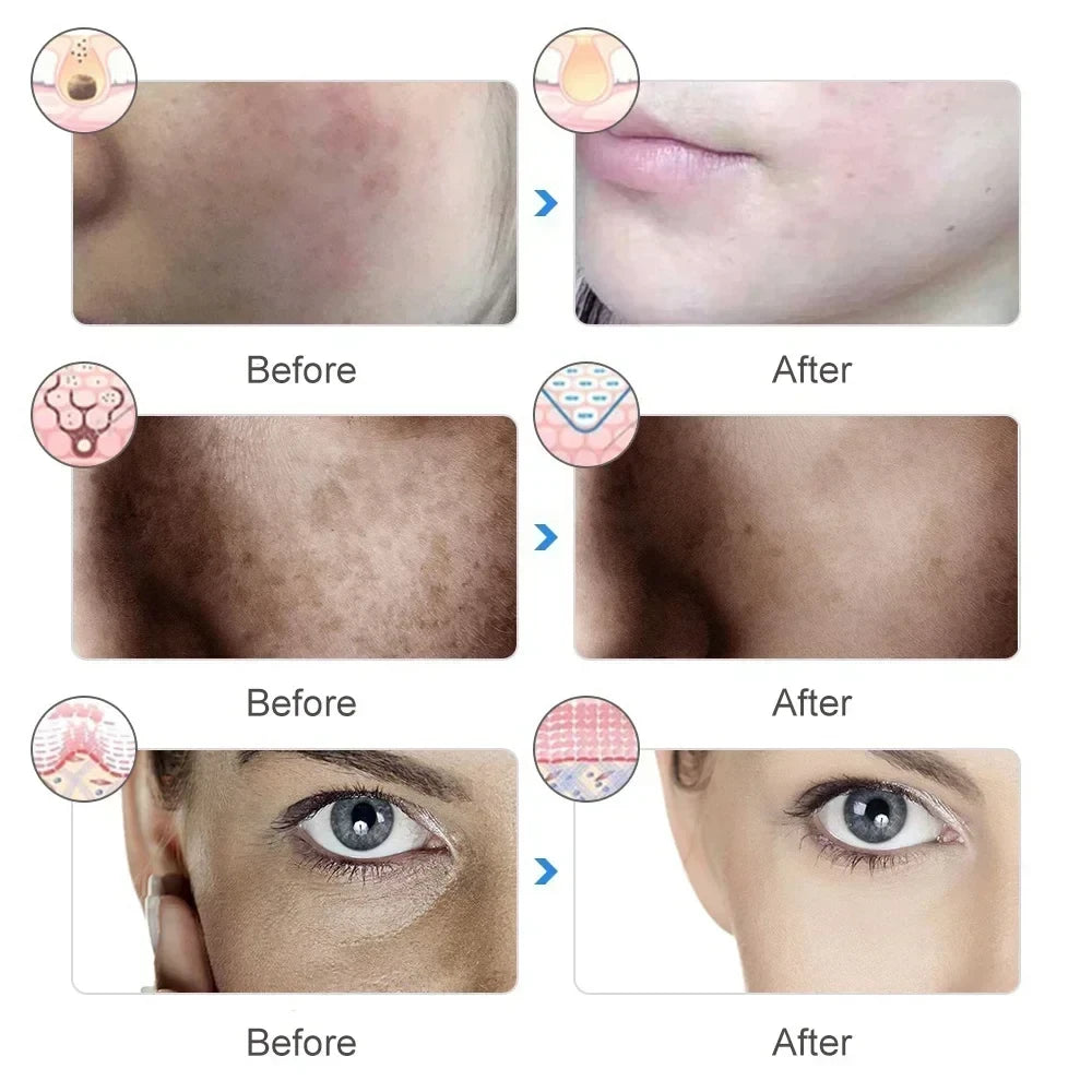 LED Face Light Mask